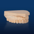Lithium Disilicate Crown IPS Emax